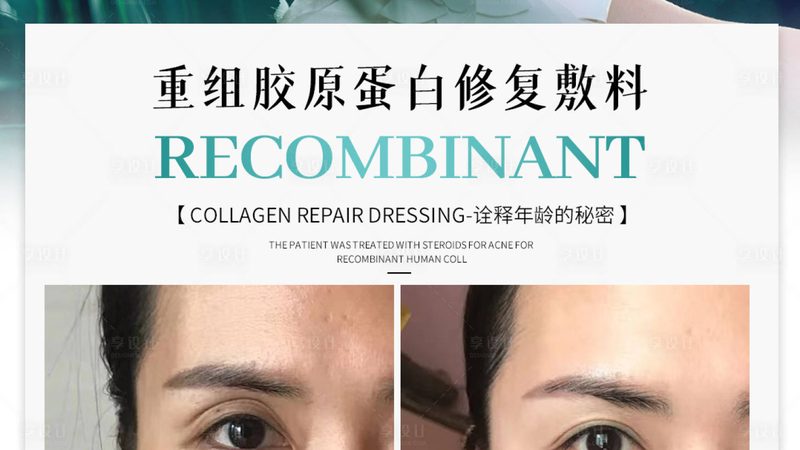 进口水光针，如何挑选品质与安全并存的选择？**