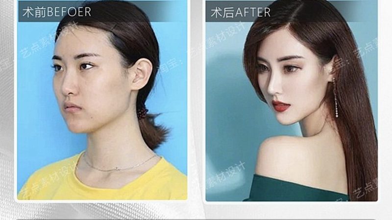 长沙整形医院术后注意事项：揭秘恢复之路