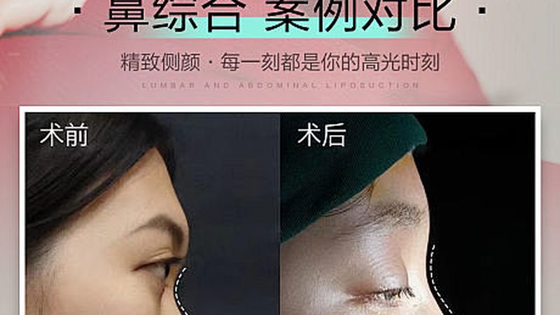 玻尿酸面膜敷完要不要涂面霜