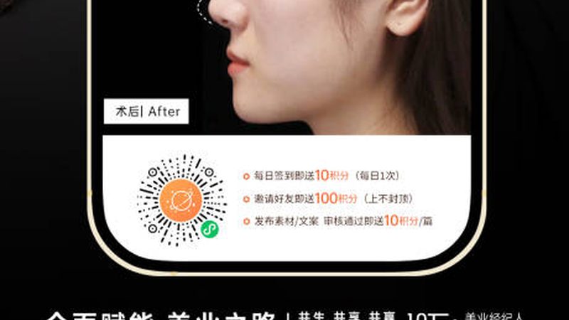 埋线提升，揭秘你的美丽蜕变之路
