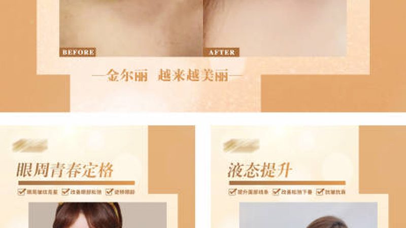 成都激光脱毛选哪种类型好