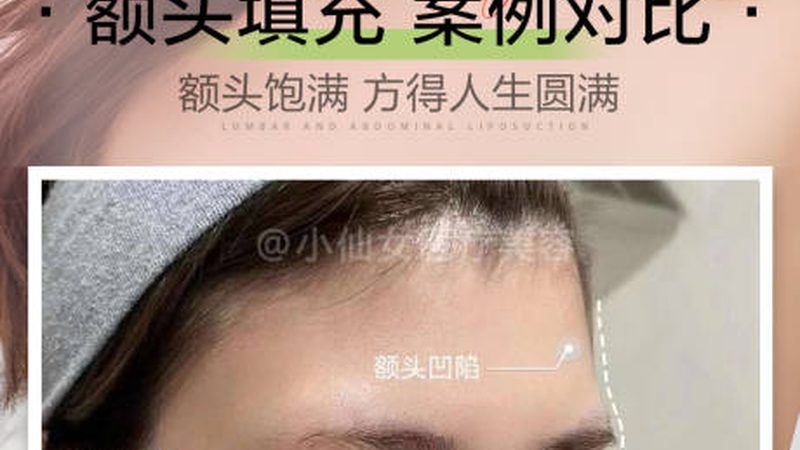 目前市场上常见的激光脱毛仪波长主要有以下几个：