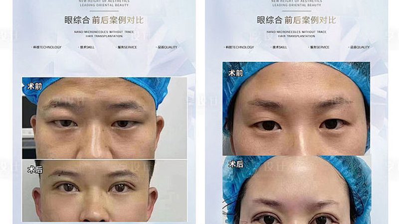 玻尿酸面膜：揭秘其制作工艺与选购要点