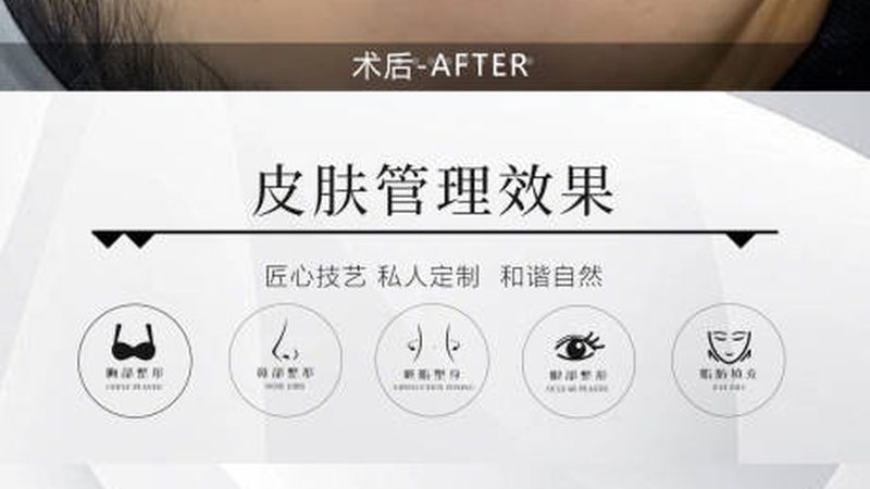 成都轻医美哪家性价比高