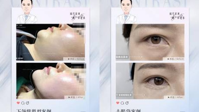 玻尿酸注射后注意事项区别