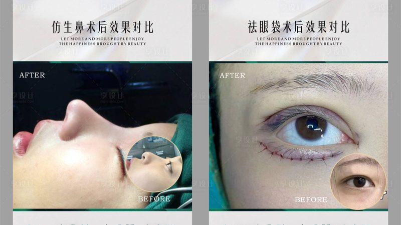 光子嫩肤美白能保持几年