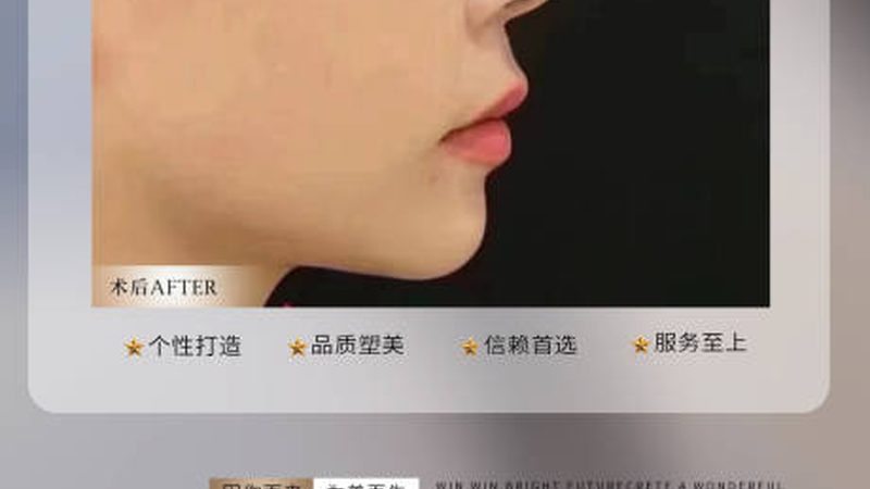 店面租金是启动资金的重要组成部分。在估算租金时，需要考虑以下因素：