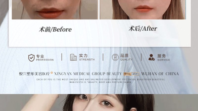 美容界的“双剑合璧”：超声炮与射频仪的原理与作用