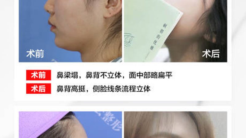 医美整形医院排名背后的考量因素