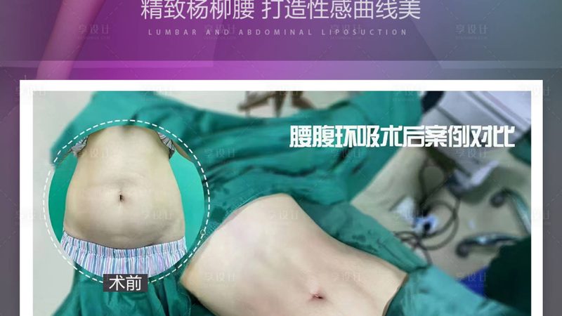 家用美容仪VS院线仪器：揭秘两者差异与适用场景