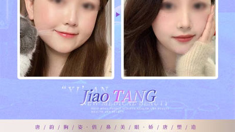 成都医美价格贵不贵有议价空间吗