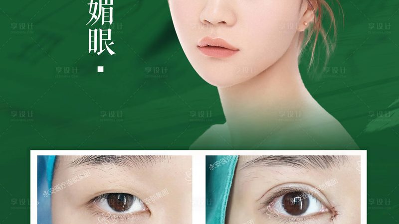 隆鼻假体材料是整形美容中常见的材料之一，目前市面上主要有以下几种：